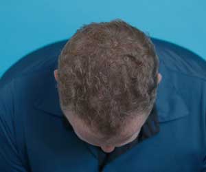 Hair Grow Max 2x1 a 1.261 CZK